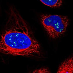 Treacher Collins syndrome protein Antibody, Novus Biologicals 0.1mL; Unlabeled:Antibodies,